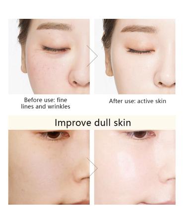 Buy Pore Minimizer Hyaluronic Acid Night Serum Capsules | Face Skin Moisturiser & Pore Refining Serum - International Shipping Available - Buy Online on GoSupps.com