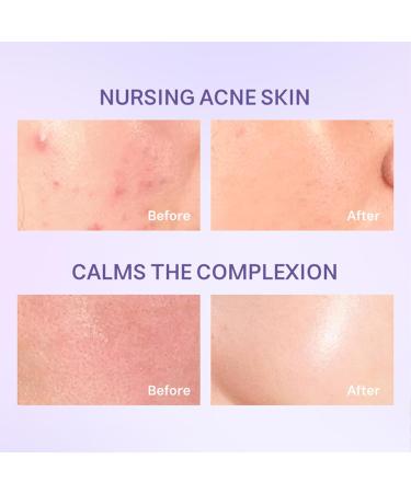 Gentle Face Cleanser Hydrating Facial Cleanser for Sensitive Skin with Blueberry Ceramides and Asiatica Cartel Barrier Repair Hydrating Face Wash for Dry Skin Oil Skin and Sensitive Skin - Buy Online on GoSupps.com