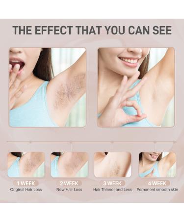 At-Home Permanent Laser Hair Removal Device | 999,999 Flashes | Painless Removal for Women and Men | Suitable for Armpits, Back, Legs, Arms, Face, and Bikini Line - White - Buy Online on GoSupps.com