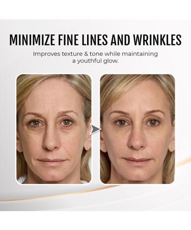 Youthful Lift Eye Firming Cream - Anti-Wrinkle Lifting Treatment for Smooth Fine Lines (3PCS) - Rejuvenate Your Skin - Buy Online on GoSupps.com