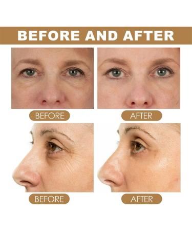 Retinol Eye Stick for Dark Circles Anti Aging Eye Cream Repairing Cream Anti Aging Eye Cream Moisturizing Firming and Lifting for Eye Skin (1pcs) - Buy Online on GoSupps.com