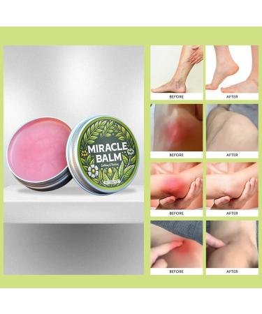 Wenrny Organic Miracle Balm for Hands Feet Legs Arms Back and Body Relaxed Comfortable Miracle Balm for Soothing Repair and Moisturizing Skin Soothing Joint Cream for Women Men 2 Pack 1 Oz - Buy Online on GoSupps.com