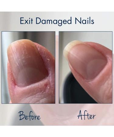 Herome Combi-Pack Exit Damaged Nails & Nail Hardener Extra Strong - Guarantees Strong Nails First Results In 8 Days - 7ml.+10ml. - Buy Online on GoSupps.com