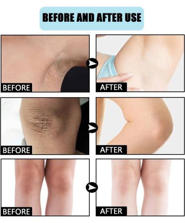 Advanced Body Whitening Cream for Underarm Knee Elbow Body Underarm Armpit Knee Armpit Armpit Neck Knees Intimate Areas (3PCS) - Buy Online on GoSupps.com