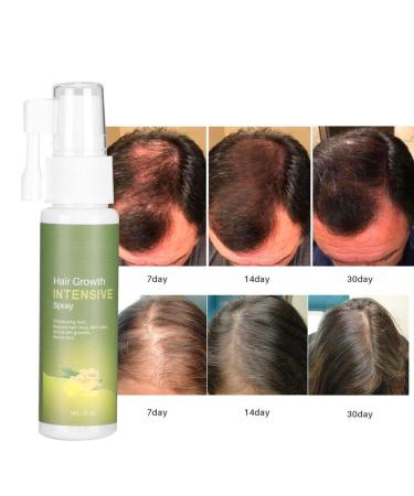 Hair Growth Serum - 30ml Moisturizing Spray for Thinning & Loss | Effective Hair Treatment & Reinforcement - Buy Online on GoSupps.com