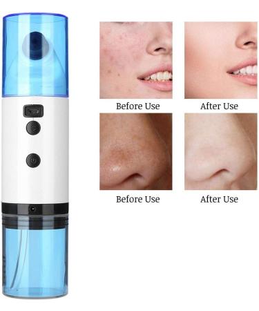 Xcello Portable Mini Electric Face Cleanse Machine Gentle Bubble Cleanser for Blackhead Suction and Pimple Removal - Buy Online on GoSupps.com