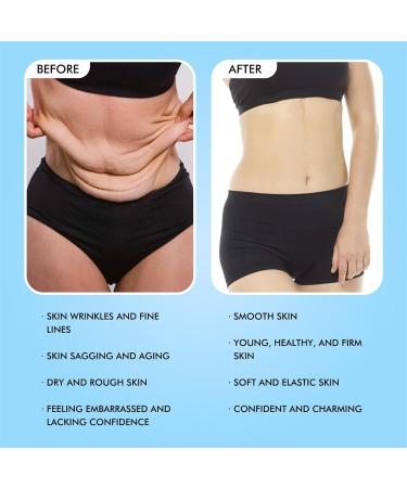 GZHGZJ Luxelift Skin Firming Youth Butter Butter Anti Aging Moisturizer For Neck Arms Legs Butt Improving Fine Crepey & Saggy Skin Hydrating Moisture For Your Skin Suitable For All Skin Types (B) - Buy Online on GoSupps.com