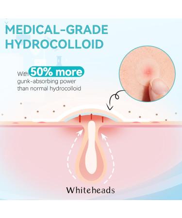 216 Pcs Invisible Hydrocolloid Pimple Patches with Tea Tree Oil - Waterproof & Breathable Acne Treatment for Day & Night - Buy Online on GoSupps.com