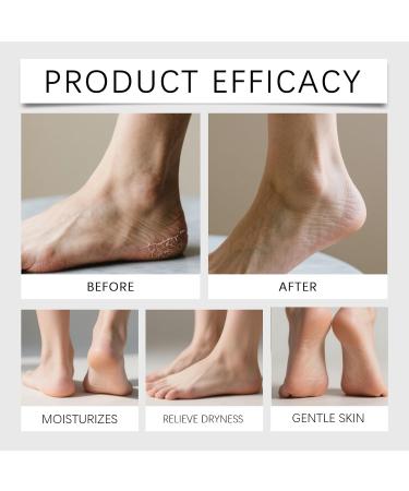  XUSHAOLUN Dual action hand and foot care Intense moisturizing cream for dry and cracked feet Repairing urea balm Light and fast moisturizing treatment for hands and feet (5PCS) - Buy Online on GoSupps.com