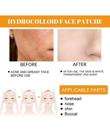 Hydrocolloid Face Patch Strips - 5 Acne Pimple Patches for Zit Breakouts on Nose Chin Forehead (4 Boxes) | International Shipping Available - Buy Online on GoSupps.com