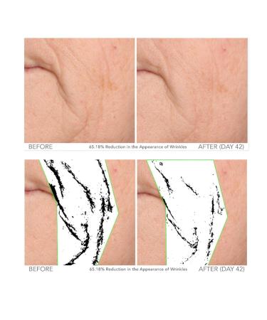 Serious Skincare Beyond Intensive Facial Treatment | 60-Day Anti-Aging Serum for Fine Lines Wrinkles & Pores - Hydrolyzed Collagen & Peptides - Buy Online on GoSupps.com