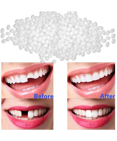 Temporary Tooth Repair Kit - 1.76 oz/50g Thermal Fitting Beads & Fake Teeth for Missing or Broken Tooth Fix | International Shipping Available - Buy Online on GoSupps.com
