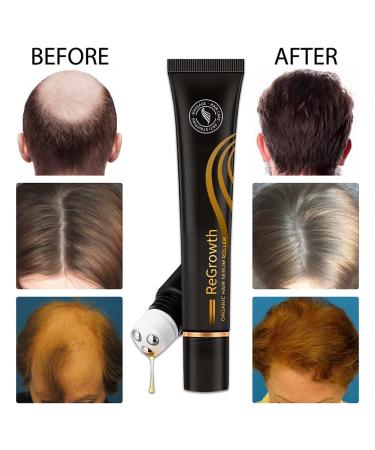 Hocossy Regrowth Organic Hair Serum Roller Set - Scalp Intense Hair Growth Treatment for Men & Women 20ml 3PCs - Natural Hair Care Solution - Buy Online on GoSupps.com