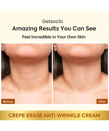 Neck Firming Cream - Anti-Aging Moisturizer with Retinol Collagen & Hyaluronic Acid for Instant Lift & Hydration - Best Wrinkle Cream for Women - Buy Online on GoSupps.com