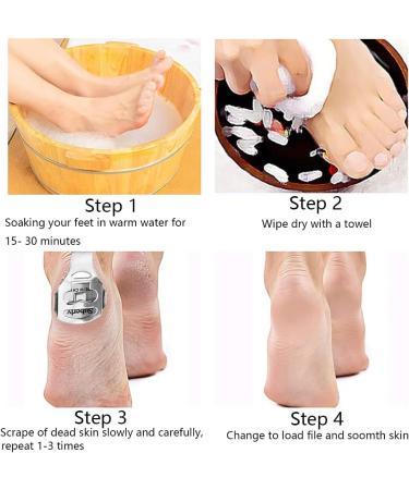 Foot Care Pedicure Shaver Stainless Steel Remover Wood Handle Heel Razor Shaver Sets Including 1 Callus Shaver 1 Foot File Heads 50 Replacement Blades Care Tools Steel Handle Hard Skin for Hand Feet solid wood - Buy Online on GoSupps.com