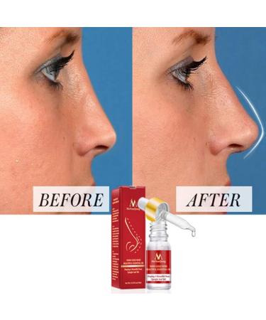 Symeas Nose Lift Up Essential Oil Firming Nourishing Nose Massage Massage Essential Oil Nose Makeup Remover Essence Nose Augment Rhinoplasty Nasal Bone Remodeling Serum - Buy Online on GoSupps.com