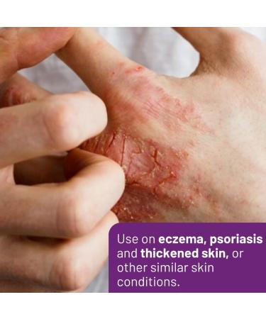 SkinRepairX 50/50 Ointment 100ml Protection for skin damaged by eczema psoriasis. Vegan Fragrance Free Suitable from Birth - Buy Online on GoSupps.com