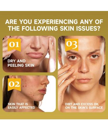  JHzood African Black Soap with Shea Butter Natural Moisturizing Body Soap 100g Cleanses and Nourishes (2) - Buy Online on GoSupps.com