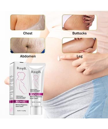 Fengyang Stretch Strips Cream - Best Scar & Stretch Mark Removal Cream for Pregnancy | 40g - Buy Online on GoSupps.com