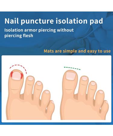 Lilybeller 40+1 Piece Professional Ingrown Toenails Treatment Set Ingrown Toenails Corrector Straightener Strips with Toenail Lifter  - Buy Online on GoSupps.com