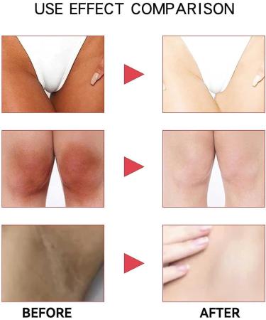 EXQST Dark Spots Correcting Cream Bleaching Cream for Dark Skin Bleaching Cream for Dark Spots Intimate Areas Lightening Cream Lightens the Dark Private Part - Buy Online on GoSupps.com