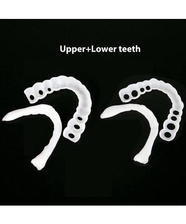 FCcassiel Snap on Veneers - Temporary Teeth Cover for Men and Women - Fix Imperfect Teeth, No Pain or Drilling - Pack of 2 - Buy Online on GoSupps.com