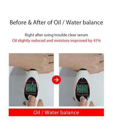 Buy Trouble Clear Serum 1.01 fl. oz - Hydrating Face Serum with Salicylic Acid for Soothing Sebum Control & Non-Comedogenic Formula - International Shipping Available - Buy Online on GoSupps.com