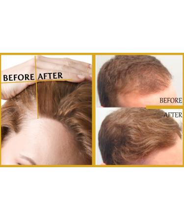 Hair Building Fibers + Hair Growth Oil with 5% Minoxidil Biotin Collagen - Thinning & Hair Loss Treatment - Medium Brown - Buy Online on GoSupps.com