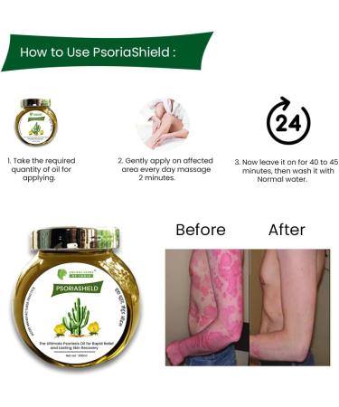Psoriasis Treatment Oil - 100% Ayurvedic Skincare for Psoriasis Eczema Vitiligo | Psoriashield | Made in India - Buy Online on GoSupps.com