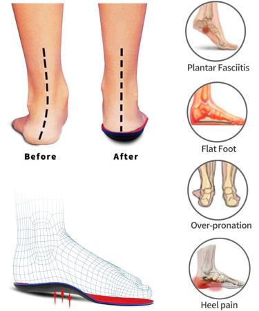 Pcssole Orthotic Arch Support Insoles for Flat Feet & Plantar Fasciitis - Men(9.5-10) 29cm - Red - Buy Online on GoSupps.com