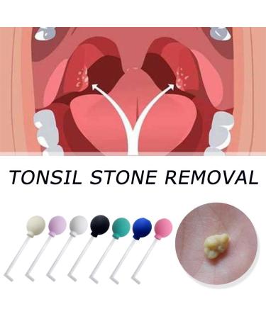 Tonsil Stone Remover Tool - Manual Style Cleaner for Ear Wax and Mouth Cleaning Care - Buy Online on GoSupps.com