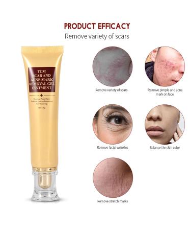 30g Scar Removal Cream for Acne Marks, Pimple, Blemishes, Stretch Marks, Burns - Treatment Ointment - Buy Online on GoSupps.com