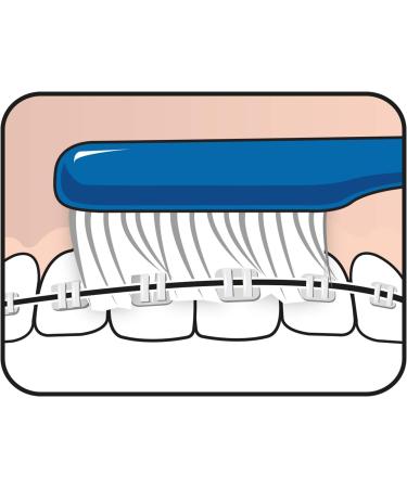 TePe Implant & Jaw-Friendly Toothbrush Pack of 3 - Ideal for Sensitive Teeth | International Shipping - Buy Online on GoSupps.com