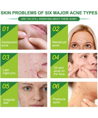 Acne Healing Patch Acne Absorbing Cover Invisible Skin Acne Treatment Stickers for Facial 24Patches acne treatment - Buy Online on GoSupps.com