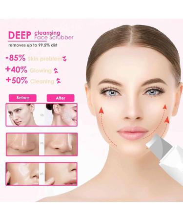 Rechargeable Facial Silicone Pore Cleaner - Waterproof Face Scrubber & Blackhead Remover for All Skin Types | 3 Modes Deep Cleansing Tool - Buy Online on GoSupps.com