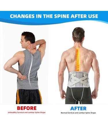 Lower Back Brace with Bionic Support - Adjustable Lumbar Belt for Herniated Disc Sciatica & Scoliosis | XX-Large Gray - International Shipping Available - Buy Online on GoSupps.com