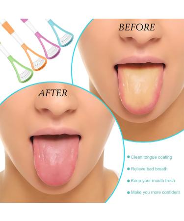 CPsyte 4-Piece 2-in-1 Tongue Cleaner Set | BPA-Free Tongue Scraping for Adults & Children | Improve Health & Fight Bad Breath - Buy Online on GoSupps.com