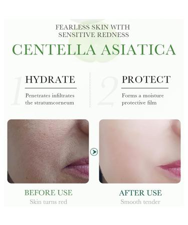 BIOAQUA Centella Asiatica Moisturizing Face Cream - Nourish Repair & Control Oil | Anti-Acne Skin Care 50g - Buy Online on GoSupps.com