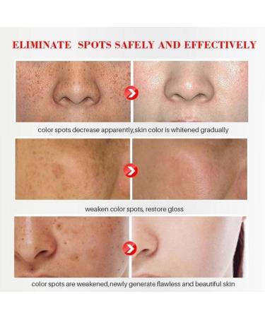 Dark Spot Remover Cream with Alpha Arbutin, Niacinamide, Collagen - for Face, Body & Sensitive Areas- Vitamin E, Bearberry, Vitamin A- Age & Sun Spot Corrector - Buy Online on GoSupps.com