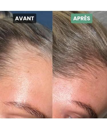 DREAM HAIR TREATMENT | Anti-hair loss | Growth and vitality | Remineralizing | Fortifying - Buy Online on GoSupps.com