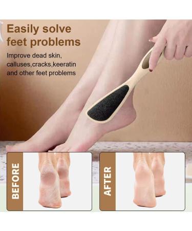 Ruayia Callus Remover Double-Sided Foot Scraper Callus Remover Dead Skin Callus Remover Feet Callus Shaver for Foot and Hand Callus Removal on Wet and Dry Feet - Pink - Buy Online on GoSupps.com