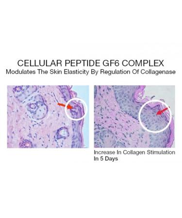 Mirenesse Cosmetics Chin Tuck V Shape Lifting Serum - Lift and Firm Your Jawline - Buy Online on GoSupps.com