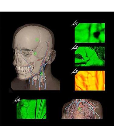 Buy Ssddlzeq Venenfinder Viewer - Portable Blood Vessel Finder for Easy Subcutaneous Vein Detection in Older Children - International Shipping Available - Buy Online on GoSupps.com