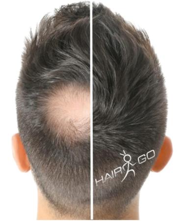  HAIR GO Premium Hair Thickening Shampoo - Hair Powder - Conditioner - For Hair Loss - 100% Natural and Vegan - 1 Pack (1 x 25g) (Dark Blonde) - Buy Online on GoSupps.com