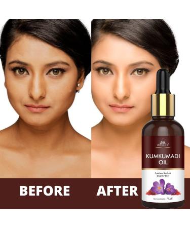 Kum.kumadi Tailam Face Oil for Radiant Skin - Natural Ayurvedic Face Serum with Saffron & Goat Milk - Targeted Dark Spot Remover Anti-Aging Brightening Glow Oil for All Skin Types 30ml - Buy Online on GoSupps.com