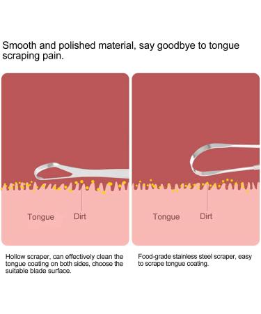 Stainless Steel Tongue Scraper Set | Reduce Bad Breath | U-Shaped & Spoon Shape Tongue Cleaner | Premium Oral Care Tool - Buy Online on GoSupps.com