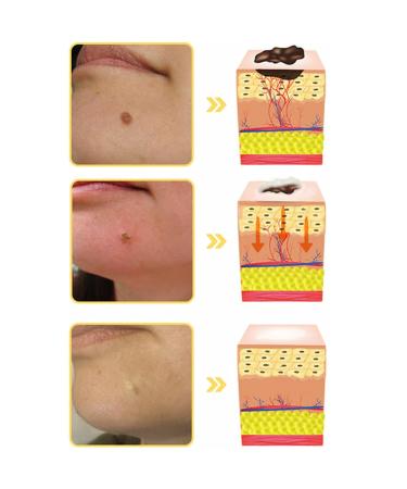 ZVLZVL Bee Venom Treatment Cream - All-Natural Hydrating Repair for Men & Women | Professional Skin Care Solution 1 Fl Oz - Buy Online on GoSupps.com