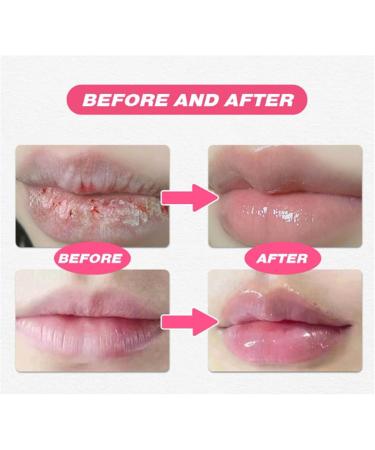 Korean Lip Serum Dark Lip Serum Moisturizing and Nourishing Lip Serum Lips Pink Fresh Treatment Balm for Dry Lips Lighten Lip Wrinkles - Buy Online on GoSupps.com