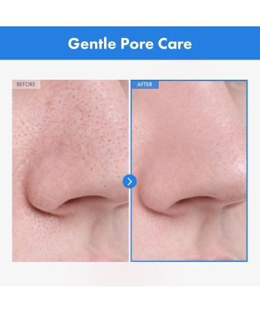 AHA Deep Cleansing Facial Oil with Jojoba & Tea Tree Oil | Korean Blackhead Remover & Pore Cleaner - 145ml - Buy Online on GoSupps.com