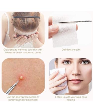 Blackhead & Pimple Popper Tool Kit for Nose & Facial Pore - Blemish Extractor for Men & Women - Christmas Present in Silver - Buy Online on GoSupps.com